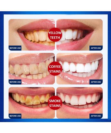 28-Pack Teeth Whitening Strips & Tooth Silk - Mint Flavor Stain Remover Kit - Buy Online on GoSupps.com