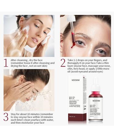 AHA 30% + BHA 2% Peeling Solution - Anti-Acne Serum & Chemical Peel for Face | BHA Liquid Exfoliant for Blemishes & Wrinkles - 1 Floz - Buy Online on GoSupps.com