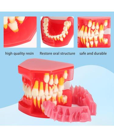Teeth Eruption Development Model | Visualize Deciduous to Permanent Teeth Transition | International Shipping Available - Buy Online on GoSupps.com