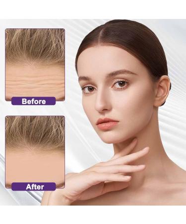 Forehead Wrinkle Patches Forehead Patches For Wrinkles Forehead Patches For Line Remover Patches Smoothing Facial Anti-Wrinkle Patches Moisturizing Mask Pads For Women Age Lines Resistant Patches - Buy Online on GoSupps.com