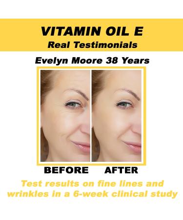 Vitamin E Oil Serum - Antioxidant Moisturizing Anti-Aging Formula for Stretch Marks & Fine Lines | 100% Natural | 2oz - Buy Online on GoSupps.com