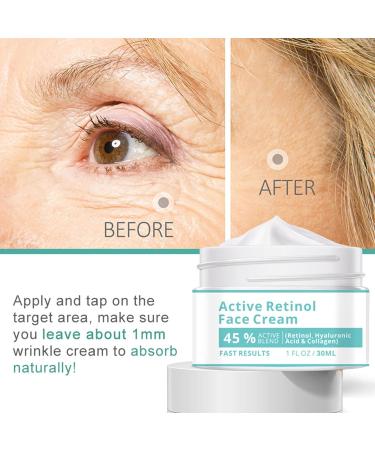  Bexdug Deep Hydration Face Cream Facial Moisturizer Natural Moisturizing Lotion | Soothing Moisturizing Cream 30ml Skin Softening Cream For Dry Skin & - Buy Online on GoSupps.com