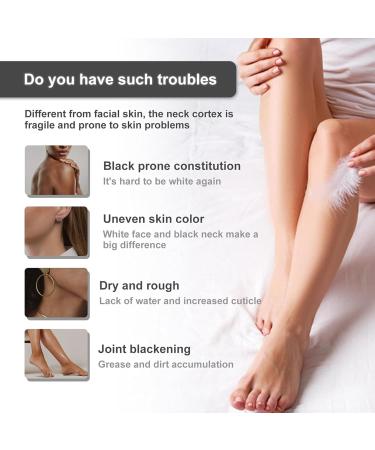 Skin Tone Even Cream 30 ml Skin Brightening Cream Lightening Cream for Armpits Even Skin Tone Body Cream for Women Private Parts Body Cream (5PCS) - Buy Online on GoSupps.com