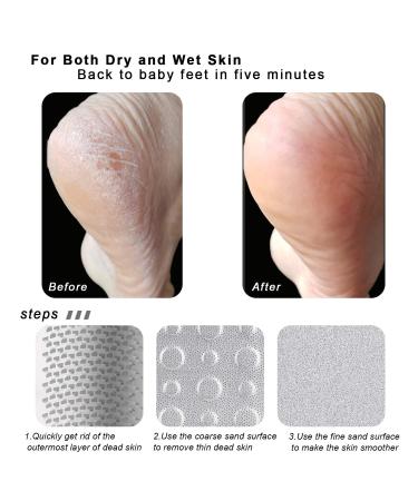 15pcs Foot Scrubber Pedicure Kit - Colossal Foot Rasp, Callus Remover Tool for Wet/Dry Feet - Surgical Grade Stainless Steel Files (Black) - Buy Online on GoSupps.com
