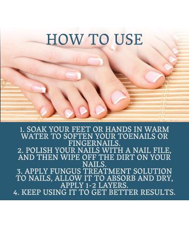 Fungal Nail Treatment - Extra Strong Nail Fungus Treatment for Toenail and Fingernail - Fungal Nail Eliminator Anti fungus Nail Repair and Strengthen Fix & Renew Damaged Broken Nails 30ml - Buy Online on GoSupps.com