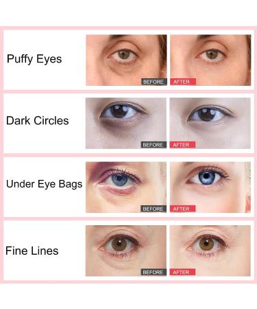 Retinol Eye Stick Duo for Dark Circles & Wrinkles - Brighten, Moisturize, & Reduce Puffiness - Anti-Aging Under Eye Treatment - Buy Online on GoSupps.com