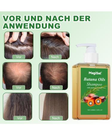  MagiSel Batana Oil Hair Growth Shampoo 100ml strengthening and regrowth formula for men and women with thinning hair or hair loss enriched with rosemary to nourish the - Buy Online on GoSupps.com