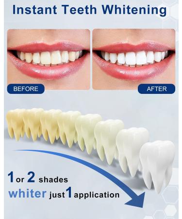 AZ Smile Teeth Whitening Pen - Set of 3 Pens for Brighter Smiles - Buy Online on GoSupps.com