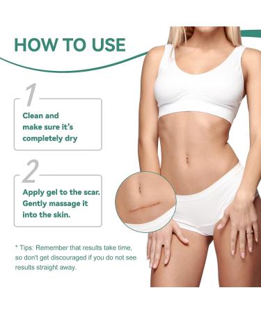Scar Gel Cream for C-Section Acne Burn Stretch Mark Tummy Tuck Keloid Removal - 50ml - Buy Online on GoSupps.com
