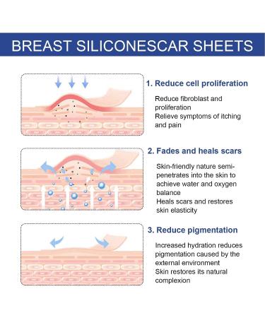 Silicone Scar Sheets | Safe Relief, Reduce & Restore Elasticity for Breast Scars - Buy Online on GoSupps.com