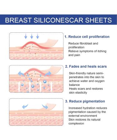 Pain Relief Scar Reduction Sheets for Breasts - Reduce Scarring and Pigmentation - Buy Online on GoSupps.com