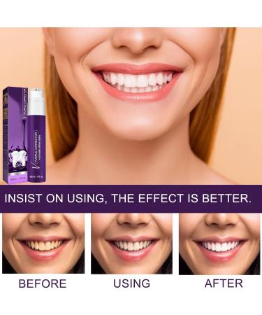 V34 Purple Toothpaste - Teeth Whitening Solution | 50ml Stain Removal for Brighter Smiles - Buy Online on GoSupps.com