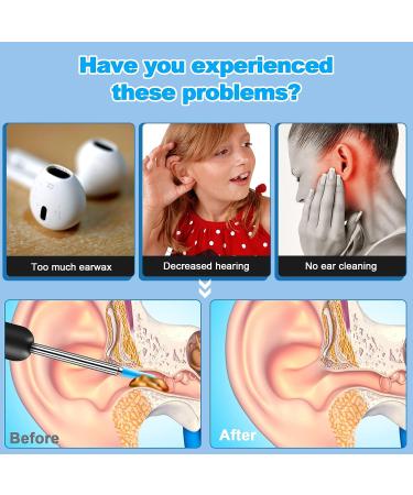 NiceBirdie 1080P Ear Wax Removal Tool with Camera and Light | Ear Cleaner Cleaning Kit with 2 Silicone Ear Scoops and 6 LED Lights - Black - Buy Online on GoSupps.com