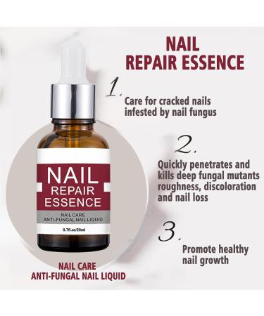 Extra Strong Fungal Nail Treatment - Nail Fungus Remover Kit with File and Brush - 20ml - Buy Online on GoSupps.com