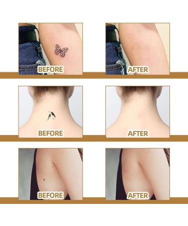 TatttooCover Up Sticker Skin Scar Pimple Sticker Skin Concealing Patches 60 Soft Breathable Latex TatttooCover Up Stickers for Scars and Taattoos Waterproof Skin Tone Inv - Buy Online on GoSupps.com
