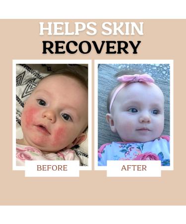 Roe Wellness Baby Cream Lotion Ointment | Moisturizing Biome Barrier Cream for Kids | Clean Ingredients for Dry Skin & Itch Relief - Buy Online on GoSupps.com