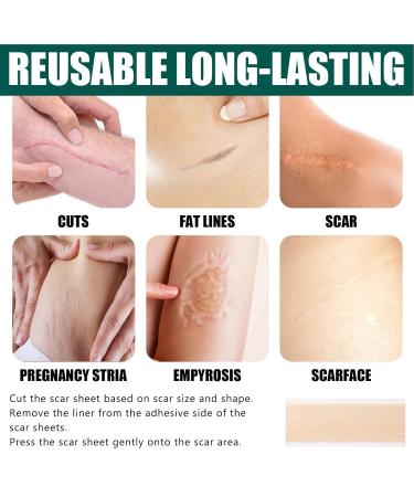 Silicone Scar Removal Tape Roll - Reusable Self-Adhesive Sheets for Hyperplastic, Burn, Keloid Scars - 59.1in - Buy Online on GoSupps.com