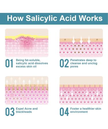 Salicylic Acid Powder 4.58 oz - Ultra Pure Cosmetic Grade No Additives | BHA Exfoliant for DIY Cleanser Toner Shampoo & Lotion - International Shipping Available - Buy Online on GoSupps.com