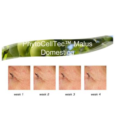 Anti-Aging. DIY Swiss Apple Stem Cell 100% Serum Booster. Remove Wrinkles Rebuild Collagen & Elastin 0.5 Fl Oz (Pack of 1) - Buy Online on GoSupps.com
