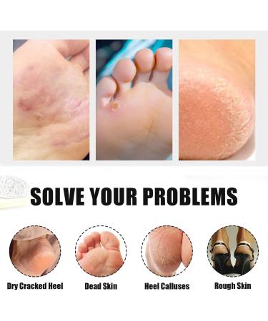 Wilsonzin Foot File for Hardened or Dry Skin Stainless Steel Callus Remover Double-Sided and 40 Replacement Sandpaper Foot Care Set Callus Planer for Pedicure Foot Care - Buy Online on GoSupps.com