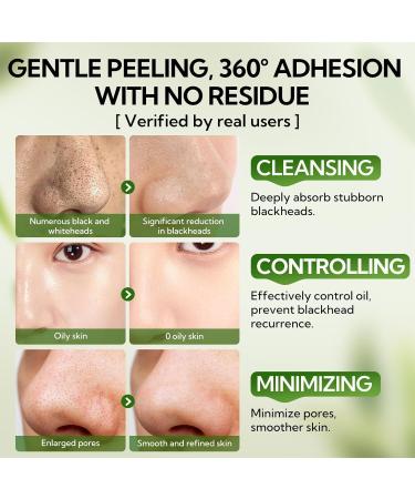  LANBENA LANBENA 60 Pcs Bamboo Charcoal Pore Strips (30g) with Blackhead Puller Black Head Puller Blackhead Remover Kit Blackhead Reshifting Kit Nose Strips for Blackhead - Buy Online on GoSupps.com