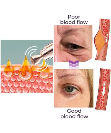 Milk Spots Electric Serum Pen 2023 Anti-Aging Moisturizing Cream for Fine Lines & Skin Care | International Shipping - Buy Online on GoSupps.com