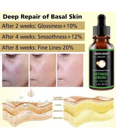 High Strength Retinol Serum for Anti-Aging | Hyaluronic Acid & Vitamin E | Reduces Wrinkles Fine Lines & Pigmentation - Sensitive Skin Formula - Buy Online on GoSupps.com