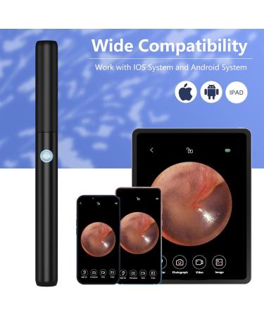 VITCOCO Ear Wax Removal Kit with 1296P Camera - Waterproof Endoscope for iPhone, iPad, Android - Ear Cleaner Tool - Buy Online on GoSupps.com