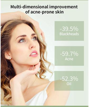 Anti Acne Removal Cream - Acne Treatment Spot and Blackheads Treatment - Day & Night Acne Gel Set - Moisturizing Skincare Fade Acne Spots Oil Control Shrink Pores - For All Skin Types 2x30ml - Buy Online on GoSupps.com