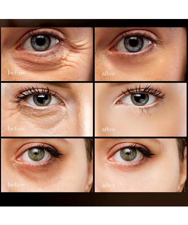 Retinol Eye Cream - Eye Cream for Dark Circles and Puffy Eyes - Caffine Eye Cream - Eye Cream Anti Aging Smooth Tender Reduce Wrinkle Fine Line - Under Eye Cream Moisture Hydrate Plump Elasticity Firm - Buy Online on GoSupps.com