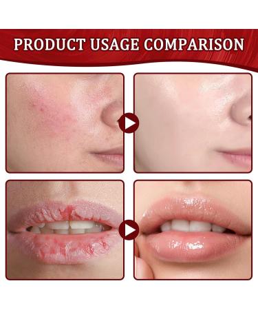 SPERMUOY Papaw Cream 3 Pieces Papaya Ointment Papaw Repairing Cream Multifunctional Moisturizing Nourishing Lip Balm Papaw Cream for Skin Lips Hands and Cuts - Buy Online on GoSupps.com