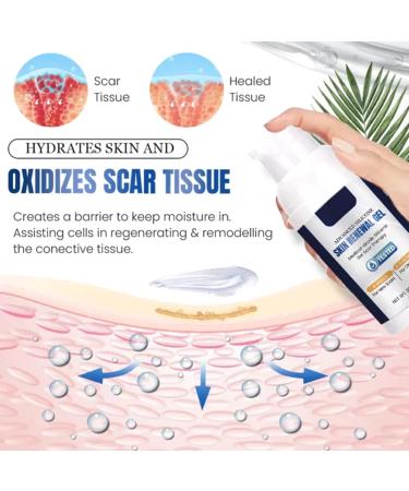 NUANYOYO Silvive Advanced Silicone Scar Removal Gel - Reduces Old & New Scars (1 Bottle) - Buy Online on GoSupps.com