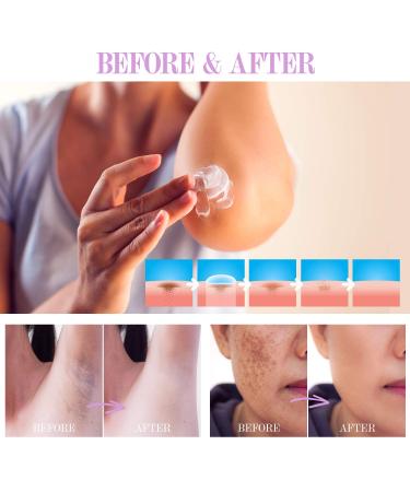 Dark Spot Corrector Cream for Body | Age/Sun/Brown Spot Treatment | Hyperpigmentation Remover | Instant Results | Moisturizes Armpit, Neck, Knees & Private Parts - Buy Online on GoSupps.com