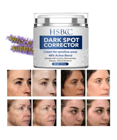 Dark Spot Remover for Face, Dark Spot Corrector, Sun Spots Melasma Freckle Remover, Hyperpigmentation Treatment, Formulated with Arbutin, Niacinamide & Vitamin E-2 Fl Oz