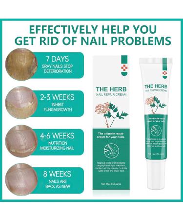 MIELIKKI Nail Repair Cream - Strengthen & Repair Damaged Nails | Nail Strengthener & Solution for Cracked & Discolored Nails - Shop Now - Buy Online on GoSupps.com