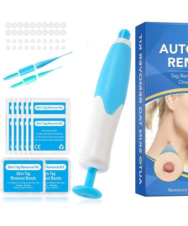 Skin Tag & Wart Remover Kit - Safe & Painless Skin Tag Removal Tool with 40 Bands & 10 Wipes - Blue - Buy Online on GoSupps.com