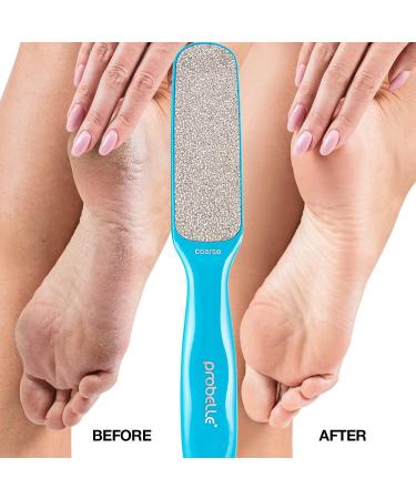 Probelle Double Sided Multidirectional Nickel Foot File - Instant Callus & Corn Remover Tool (Blue) Safe & Effective Foot Care - Buy Online on GoSupps.com