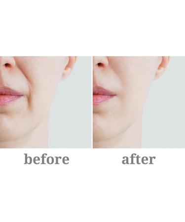 Vitality Precision Skin Retinol Pads 0.5% - 3 Month Supply for Youthful Skin | International Shipping Available - Buy Online on GoSupps.com
