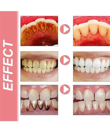 Buy Today's Lightning Deal: Prime Baking Soda Toothpaste - Whiten Teeth & Freshen Breath - 2024 Hot Pink 1 oz - Buy Online on GoSupps.com