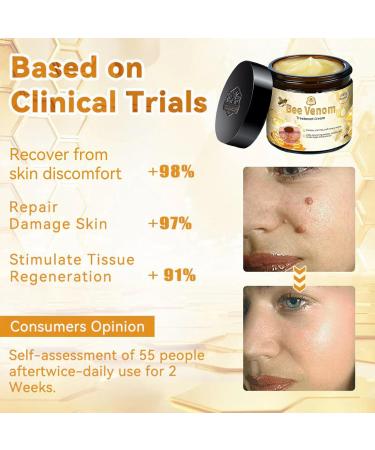 Bee Venom Skin Treatment Cream Bee Venom Cream Effectively reduces all types of skin blemishes(1PC) - Buy Online on GoSupps.com