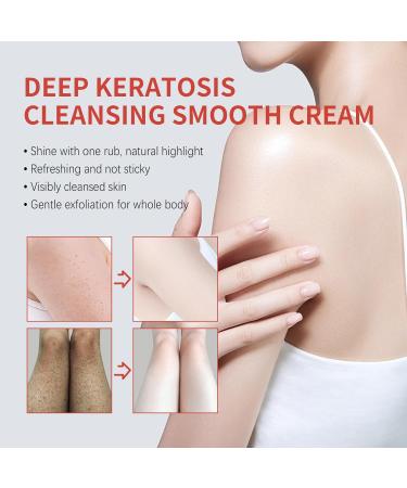 Keratosis Pilaris Cream Strawberry Legs Treatment Cream for Women Exfoliating Body Cream Skin Exfoliating Repair Cream Chicken Skin Treatment Moisturizing Cream Gets Rid Of Redness - Buy Online on GoSupps.com