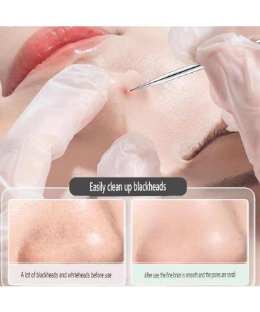 Usiveinborn Blackhead Remover Usiveinborn Tweezers Professional Stainless Steel Facial Blackhead Remover Tweezers Professional Facial Blackhead Remover Tweezers (Set-A) - Buy Online on GoSupps.com