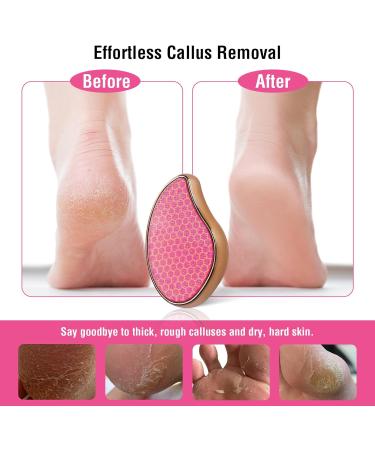 Nano Glass Heel Scraper - Foot Shower Scrubber & Dead Skin Remover | Pink Pedicure Tool for Back Arms & Legs Care - Buy Online on GoSupps.com