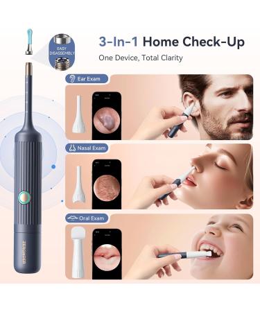 Ear Wax Removal Tool Camera: ZERONDER Ear Cleaner with Flexible Ear Scope - Visual Camera 1080P HD for Adults & Kids - Safe Ear Cleaning Tool for Home Use White - Buy Online on GoSupps.com
