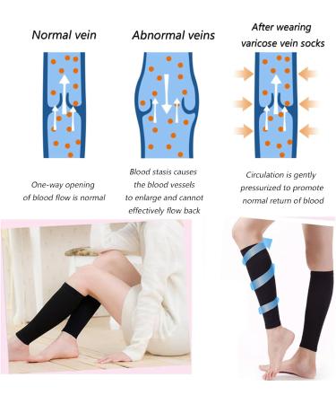 High-Quality MDRCG Waden Compression Stockings | Calf Bandage & Support Socks for Varicose Veins - International Shipping Available - Buy Online on GoSupps.com