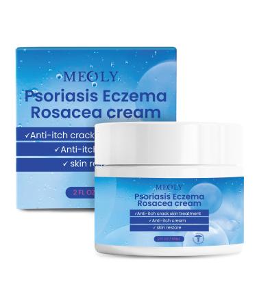 MEOLY Psoriasis Eczema Rosacea Cream Anti-Itch Cream Skin Crack Dry Skin Treatment Skin Irritation rashes Relief Seborrheic Dermatitis Cream Eczema Specialized Treatment 60 ML