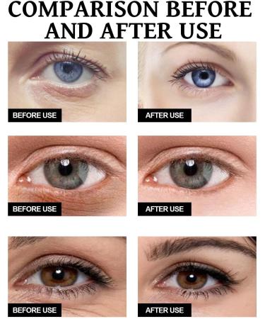 Celyz Eye Cream Celyn Instant Firm Eye Cream Ceeyn Eye Tightener for Puffiness and Bags Under Eyes Fade Fine Lines (3pc) - Buy Online on GoSupps.com