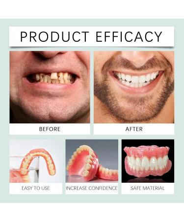 Bikenda Premium Full Set Dentures - Solution de proth se flexible de nouvelle g n ration pour hommes et femmes | Proth ses dentaires souples confortables et adapt es (1pcs) - Buy Online on GoSupps.com