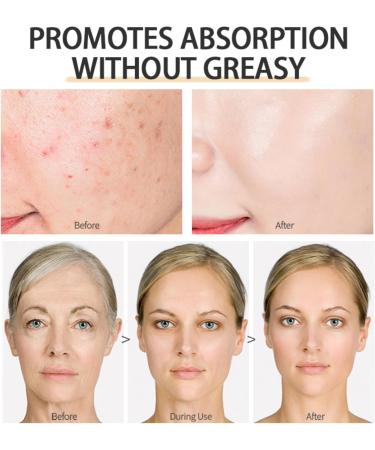 Black Honey Cream Face Moisturiser Face Women & Men Anti Aging Face Cream Face Moisturiser for Dry Skin Honey Nourishing And Moisturizing Face Cream Day/Night For Dry And Sensitive Skin - Buy Online on GoSupps.com