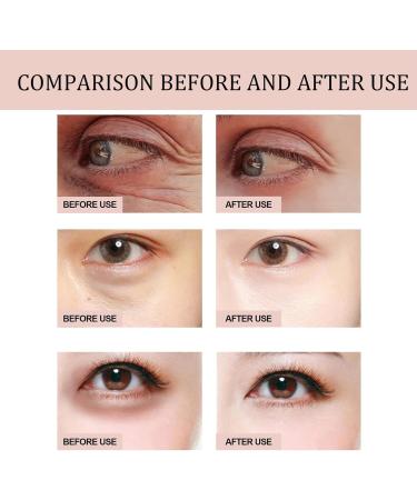 Retinol Eye Cream Stick | Eye Cream Anti Aging Bag Balm Under Eye Cream For Dark Circles Dark Circles Under Eye Treatment | Brightening & Illuminating Formula | Refreshes Eyes - Buy Online on GoSupps.com